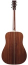 Collings D2HA Adirondack 2025-7.jpg