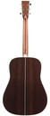 Martin HD28 Standard Refresh Ambertone-6.jpg