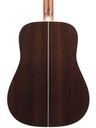 Martin HD28 Standard Refresh Ambertone-7.jpg