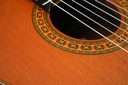 Asturias Standard Concert Spruce Rosewood 2000(?)-11.jpg
