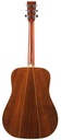 Martin D35 Lefty 1975-6.jpg