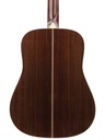 Martin D28 Marquis Sunburst 2015-6.jpg